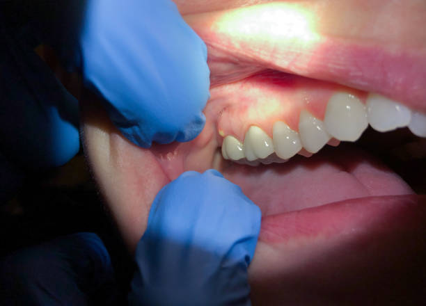 Best Emergency Treatment for Jaw Pain or Injury in Pittsfield, IL